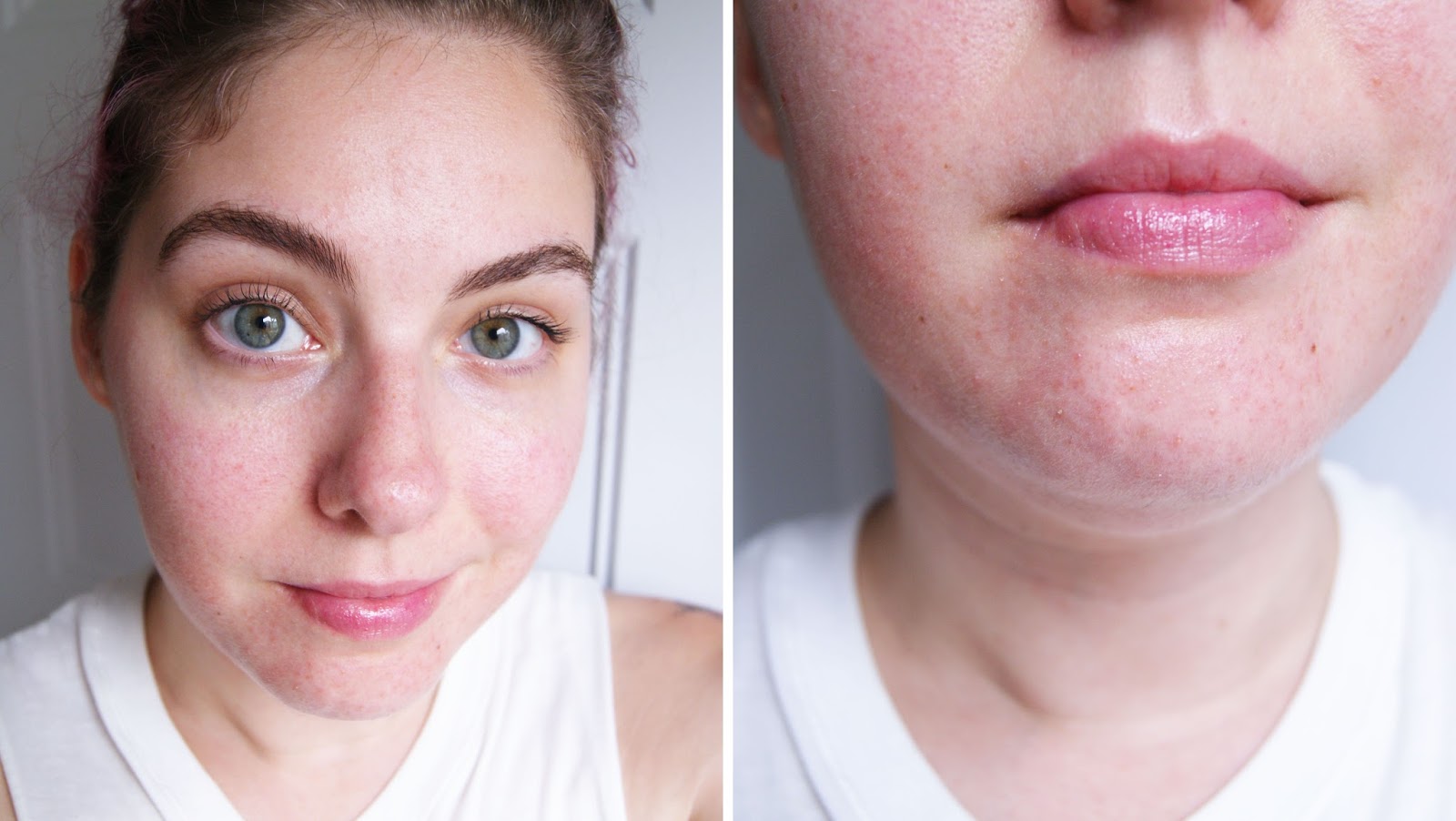 The Future of Skin Care Neutrogena Light Therapy Acne Mask Review