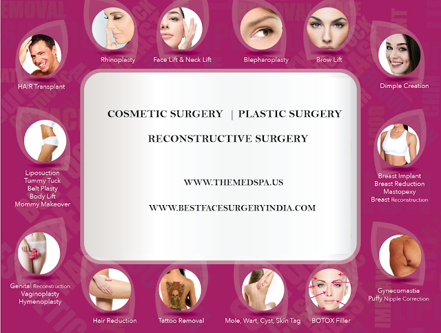 Cosmetic surgery in Delhi 