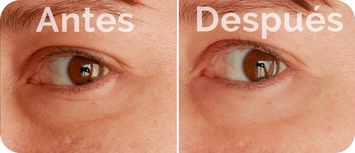 El Increíble Producto Que Acabará Con Tus Ojeras Y Puedes Conseguir En Mercadona Por Menos De 4 Euros 7 Actúan Donde Deben Hacerlo