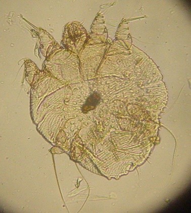 Jenis-Jenis Arthropoda Patogen (Sikilus Hidup, Gejala Klinis, Pencegahan & Pengobatan)