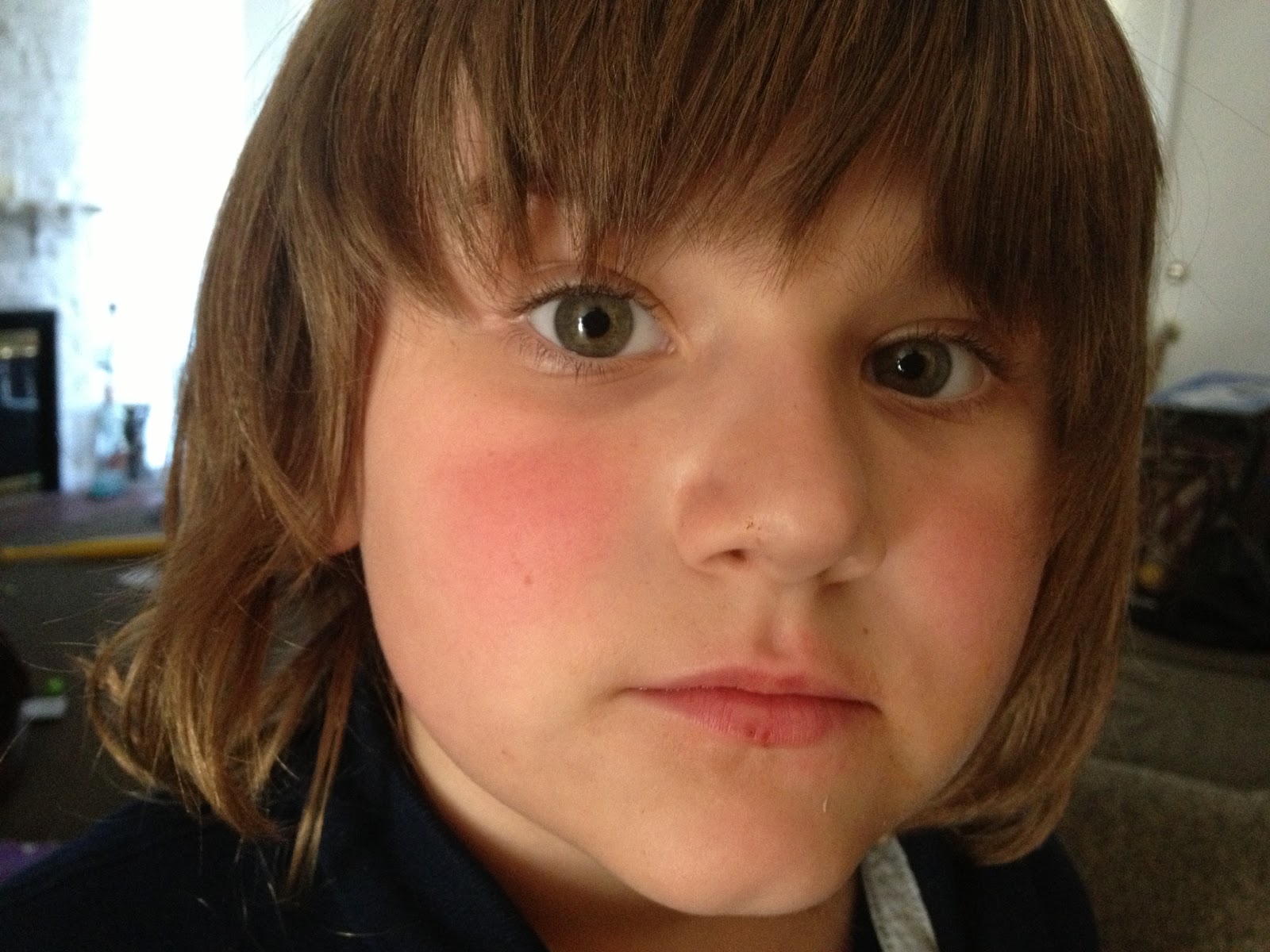 Life with Lupus DJ's battle