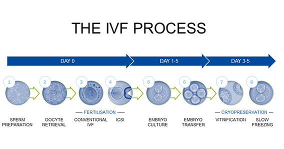 Day process. In vitro fertilization. What is IVF. IVF-M 75. IVF-508 диски.