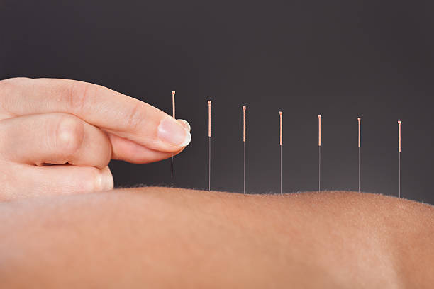 Tops Tips About Acupuncture That Anyone Can Follow Tops Tips About Acupuncture That Anyone Can Follow