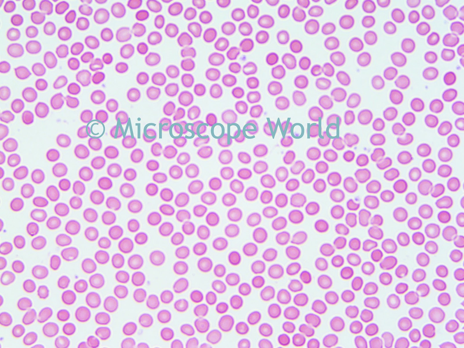 Microscope World Blog Comparing Biological Digital Microscopes