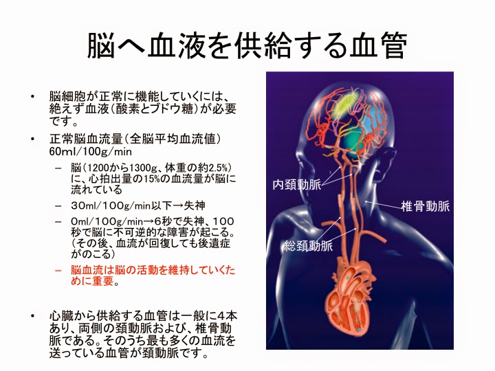 松戸脳卒中最前線 頚動脈狭窄症(けいどうみゃくきょうさくしょう)といわれたら。。 松戸脳卒中最前線 頚動脈狭窄症(けいどうみゃくきょうさくしょう)といわれたら。。