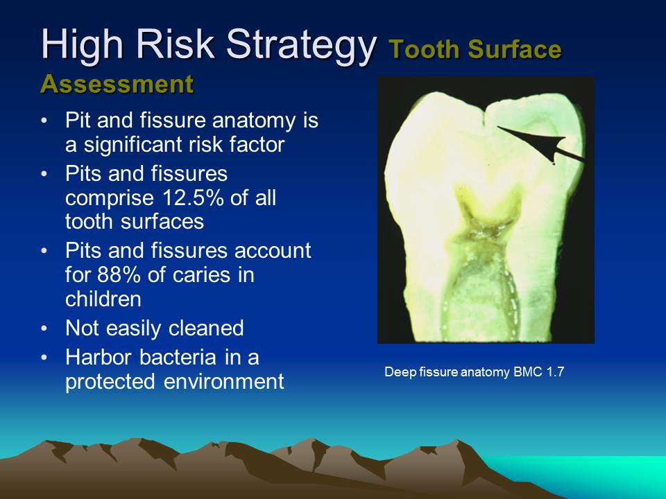 Dentistry Caries Risk Assessment