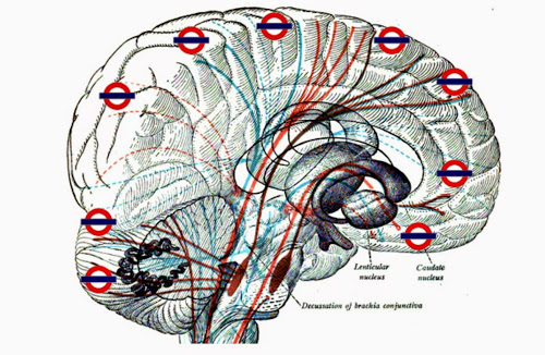 IQ's Corner: What the brain's wiring looks like