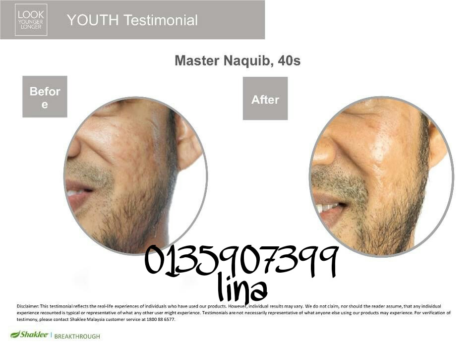 Penjagaan Wajah Lelaki Untuk Kehidupan Aktif