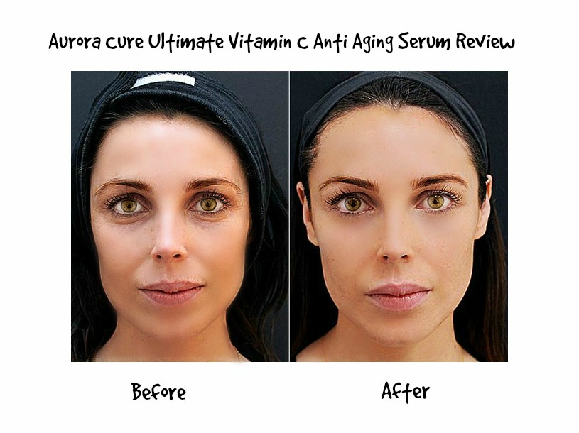 Vitamin C Supplement Skin Before After One thing that kept Timeless
