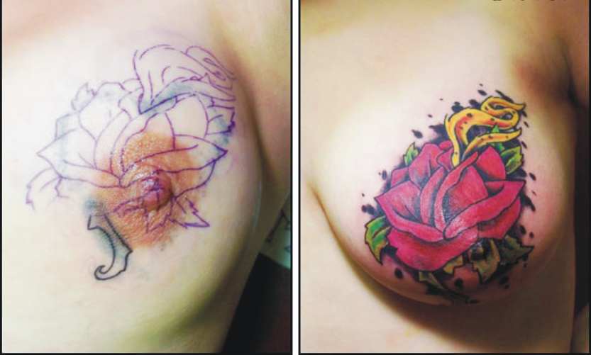 Tattooing' On Nipples Is The Latest Beauty Craze In The UK.