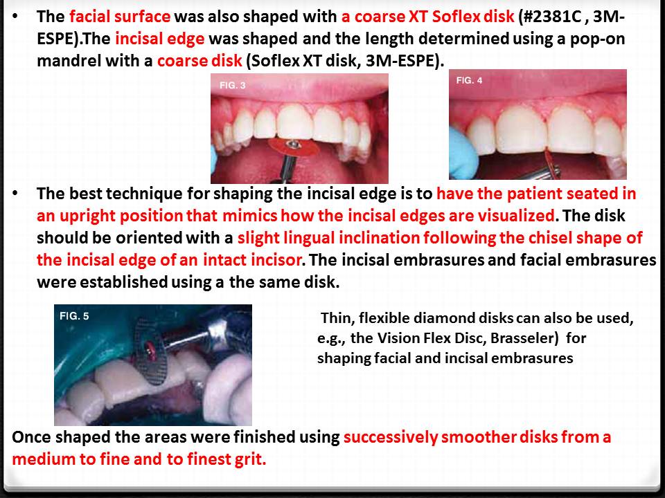 DOs and DONTs in DENTISTRY Polishing Composite Restorations EASY