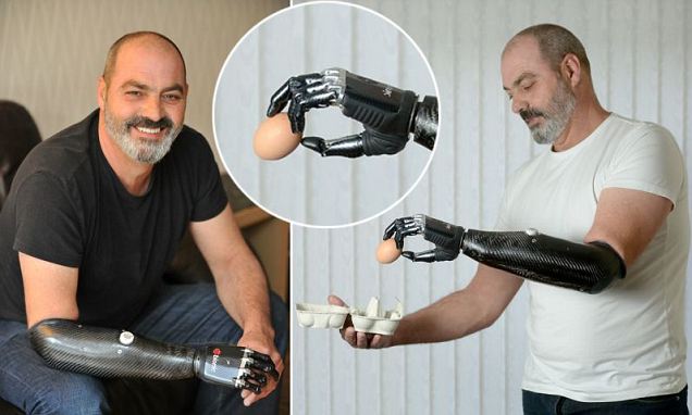 Mercedes bionic arm #6
