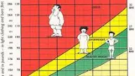 What is the Definition of Body Mass Index? Determine Your BMI and Save
Your Life - Cataract Risk & Body Mass Index (BMI)