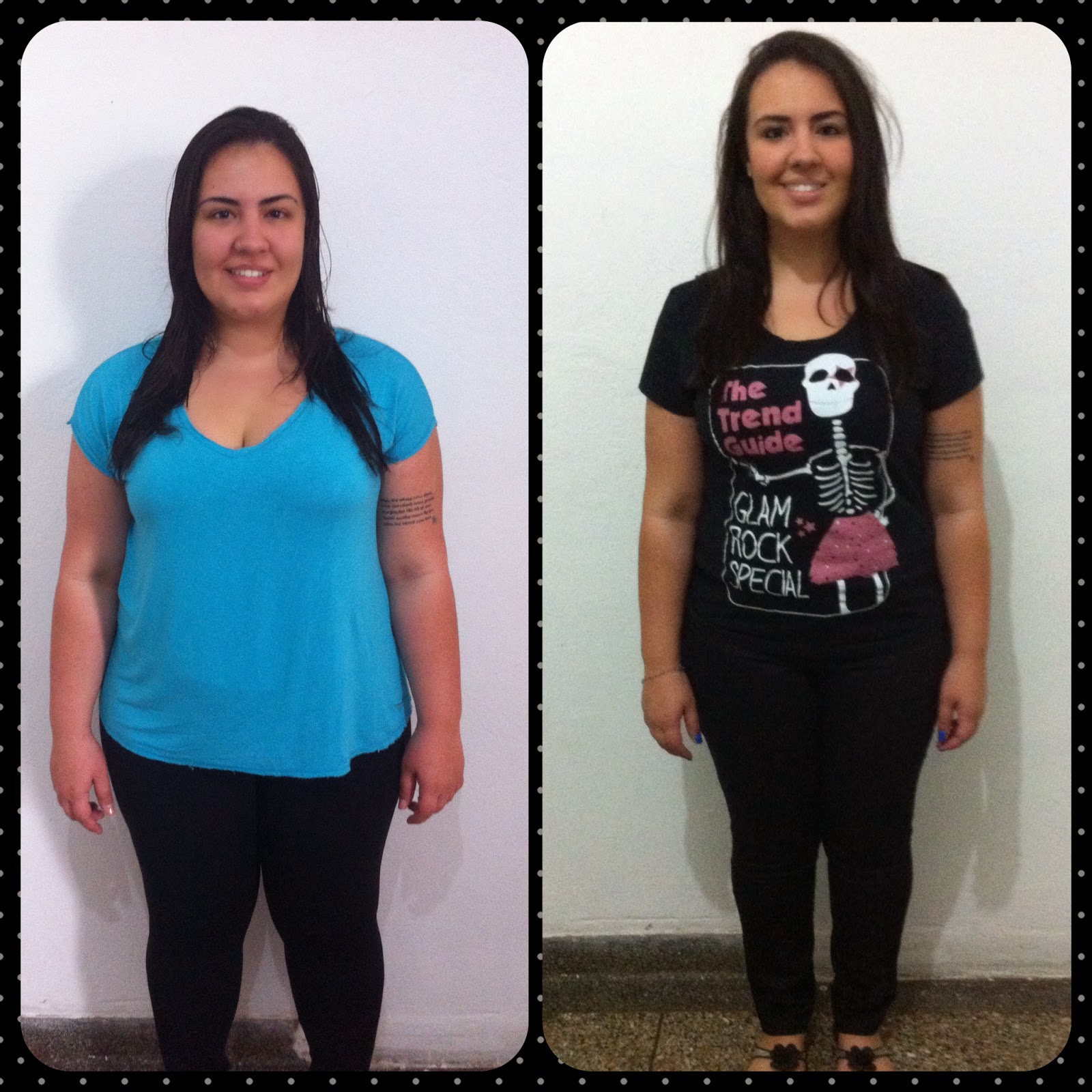 A minha conquista Antes e Depois 2º mês de Bariatrica