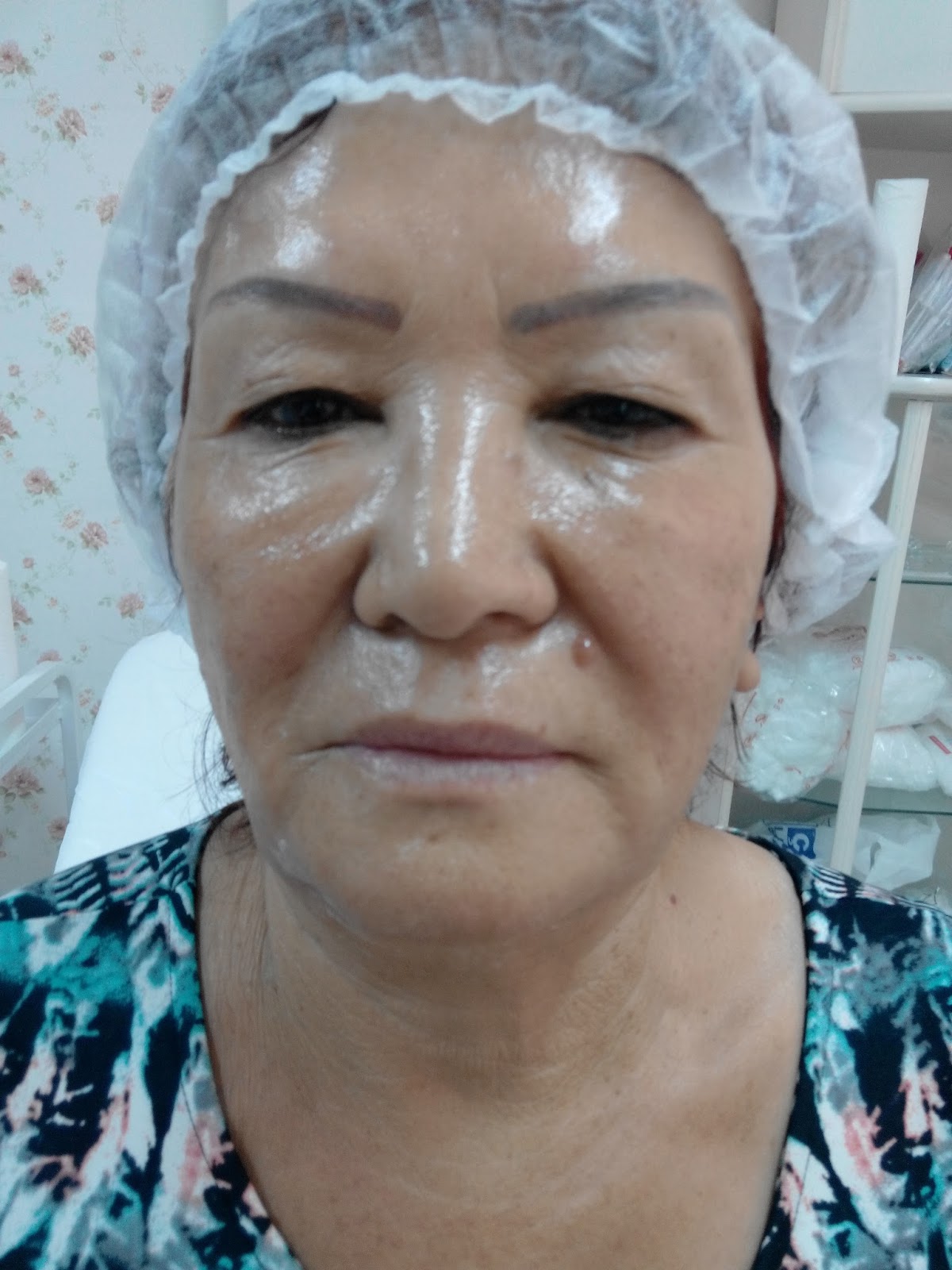 Etiket: gıdı sarkması Etiket: gıdı sarkması