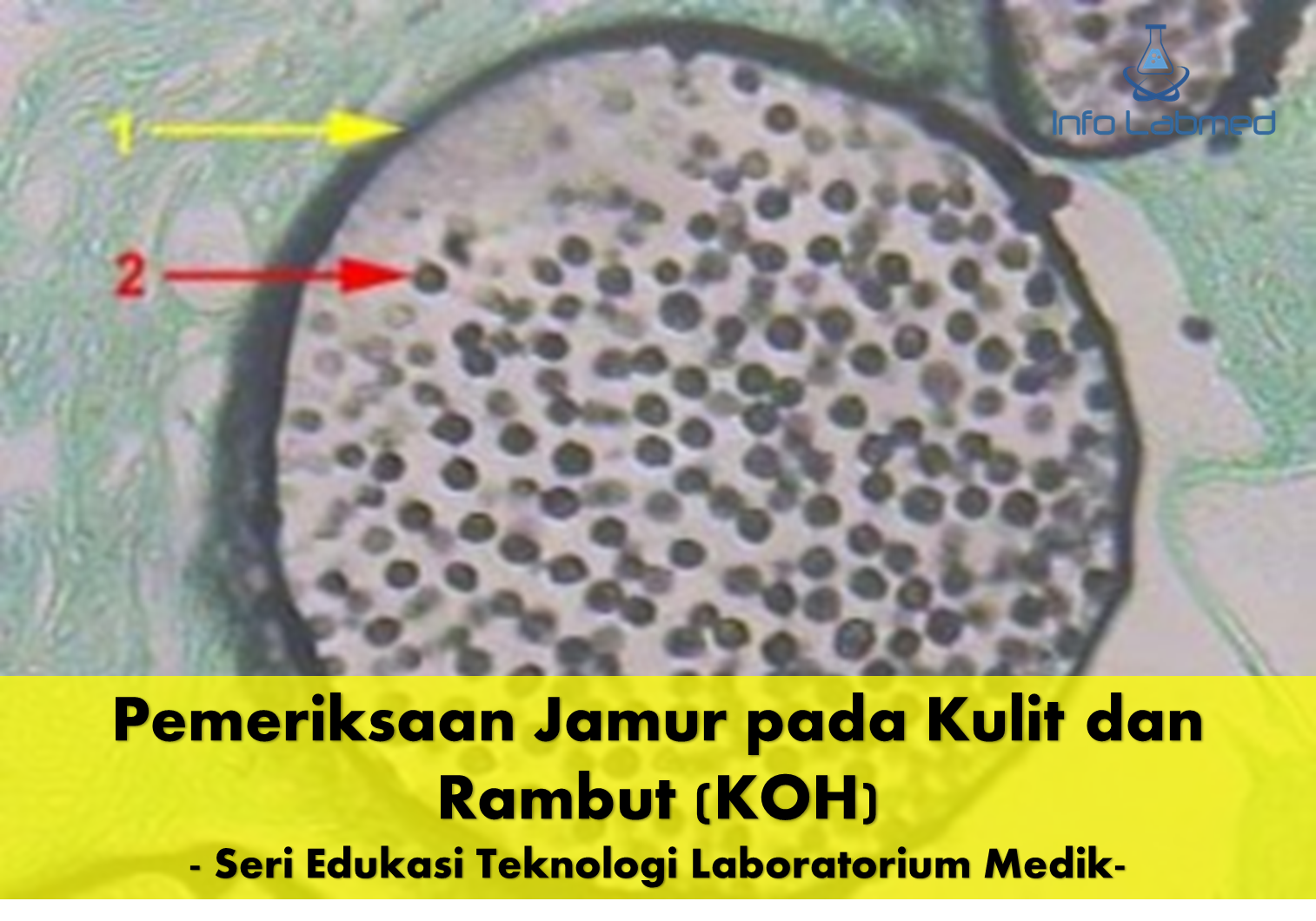 Gambar Jamur Kulit Di Wajah