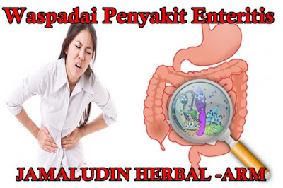 http://arumherbal30.blogspot.co.id/2017/11/pengobatan-penyakit-enteritis-secara.html