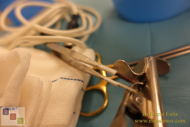 Bademcik Ameliyatı ve Geniz Eti Ameliyatı Kimler İçin Gereklidir?