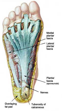 A Runners Progress: Plantar Fascia Pain