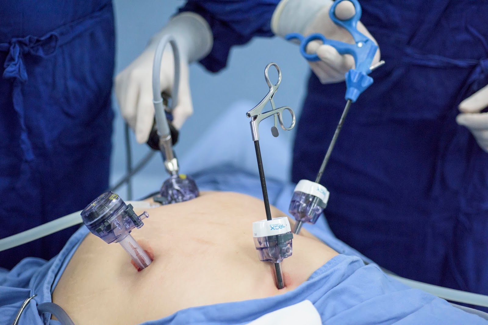 Gus slotman md Gus slotman md