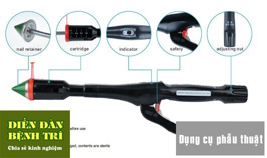 PHẪU THUẬT CẮT TRĨ BẰNG PHƯƠNG PHÁP LONGO VÀ TRẢI NGHIỆM THỰC TẾ ...