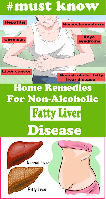 Home Remedies For Non-Alcoholic Fatty Liver Disease