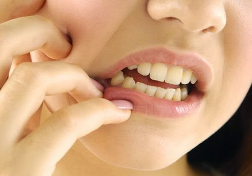 9 Penyebab dan Obat Sakit Gigi Ngilu