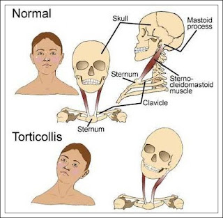 Inilah 4 Penyakit yang Akan Menyerang Kita jika Terlalu Sering Menggunakan Kipas Angin atau AC!. Inilah 4 Penyakit yang Akan Menyerang Kita jika Terlalu Sering Menggunakan Kipas Angin atau AC!.