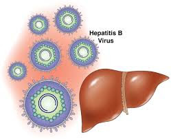 Cara mengobati hepatitis c