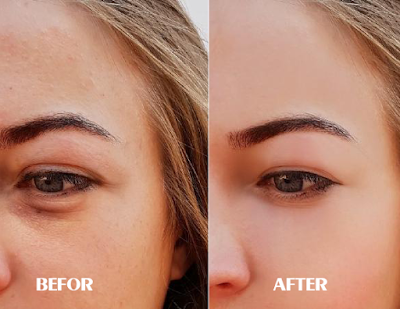 How To Get Rid Of Puffy Under Eyes Permanently How To Get Rid Of Puffy Under Eyes Permanently