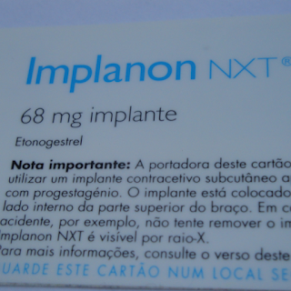 Engravidar depois de tirar o implanon® (implante hormonal)