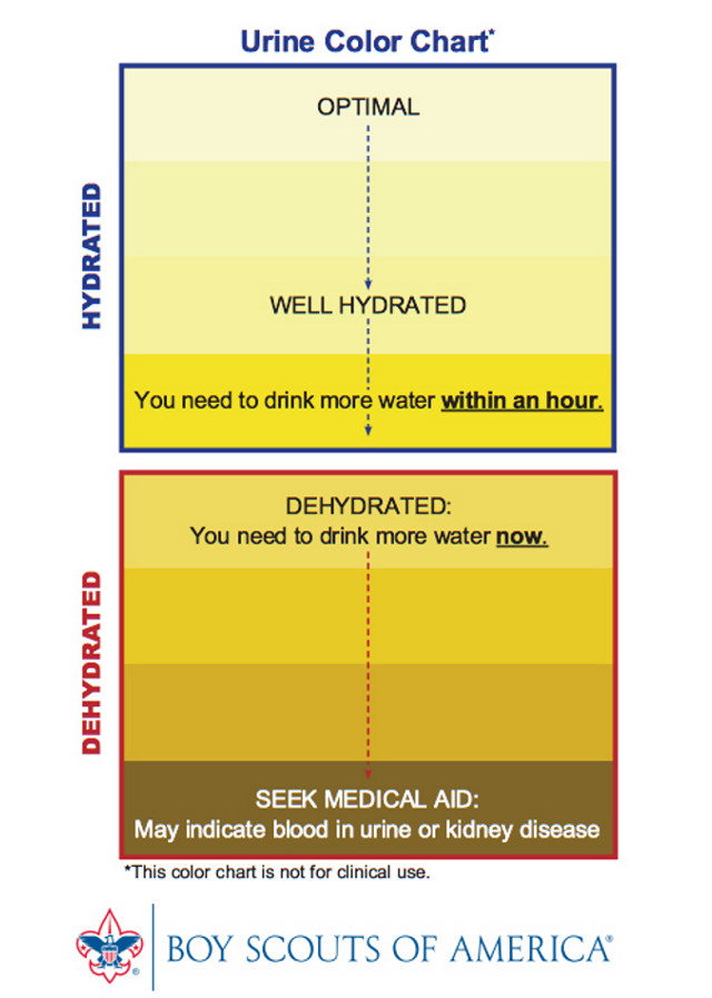 Urine Color Chart In Spanish