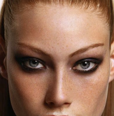 seboreik dermatit tedavisi 6 webkenti