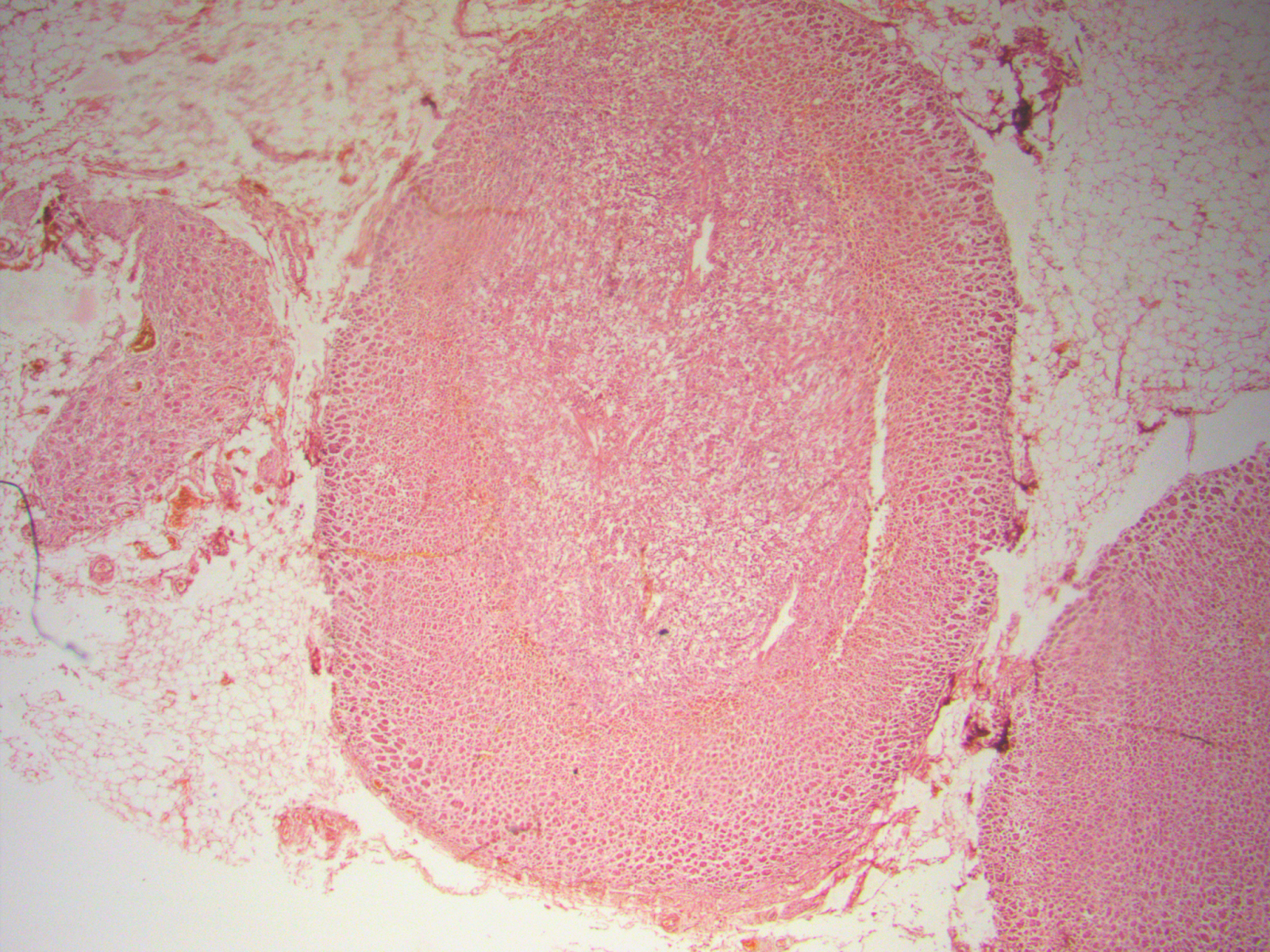 into the roots Adrenal gland