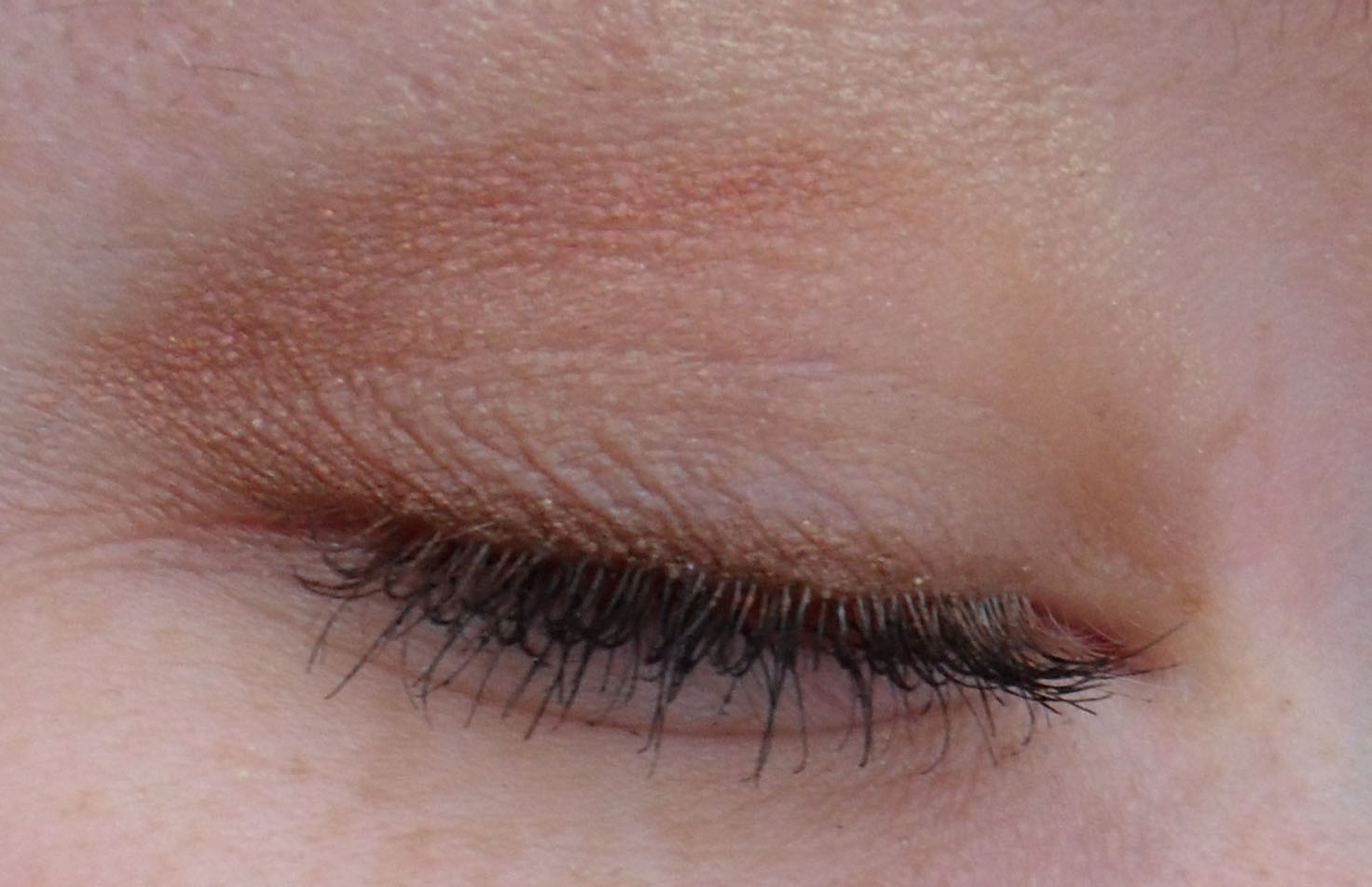 Blepharitis And Mascara