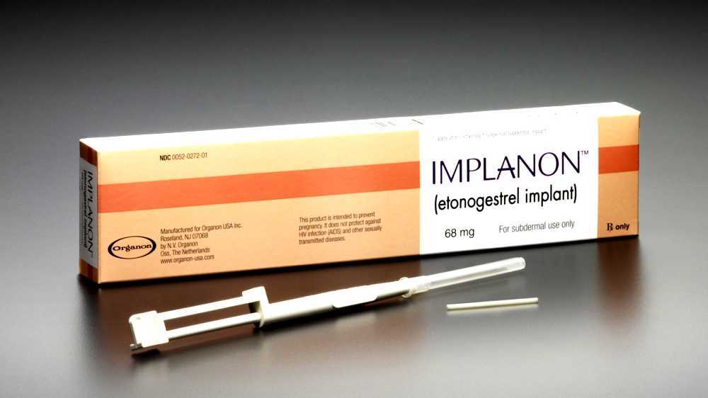 Etonogestrel birth control implant