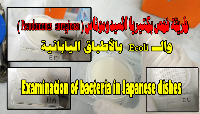 طريقة فحص بكتيريا السيدوموناس ( Pseudomonas  auroginosa ) والــEcoli  بالأطباق اليابانية  Examination of bacteria in Japanese dishes