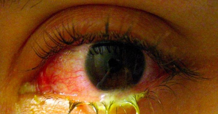 Obat Tetes Mata untuk Kucing