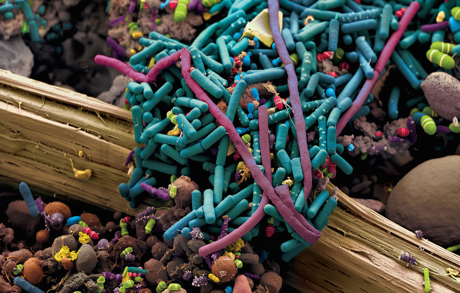 Бактерии домашних условиях. Бактерии под микроскопом. Микроорганизмы под микроскопом. Бактерии кишечника под микроскопом. Микробы фото.