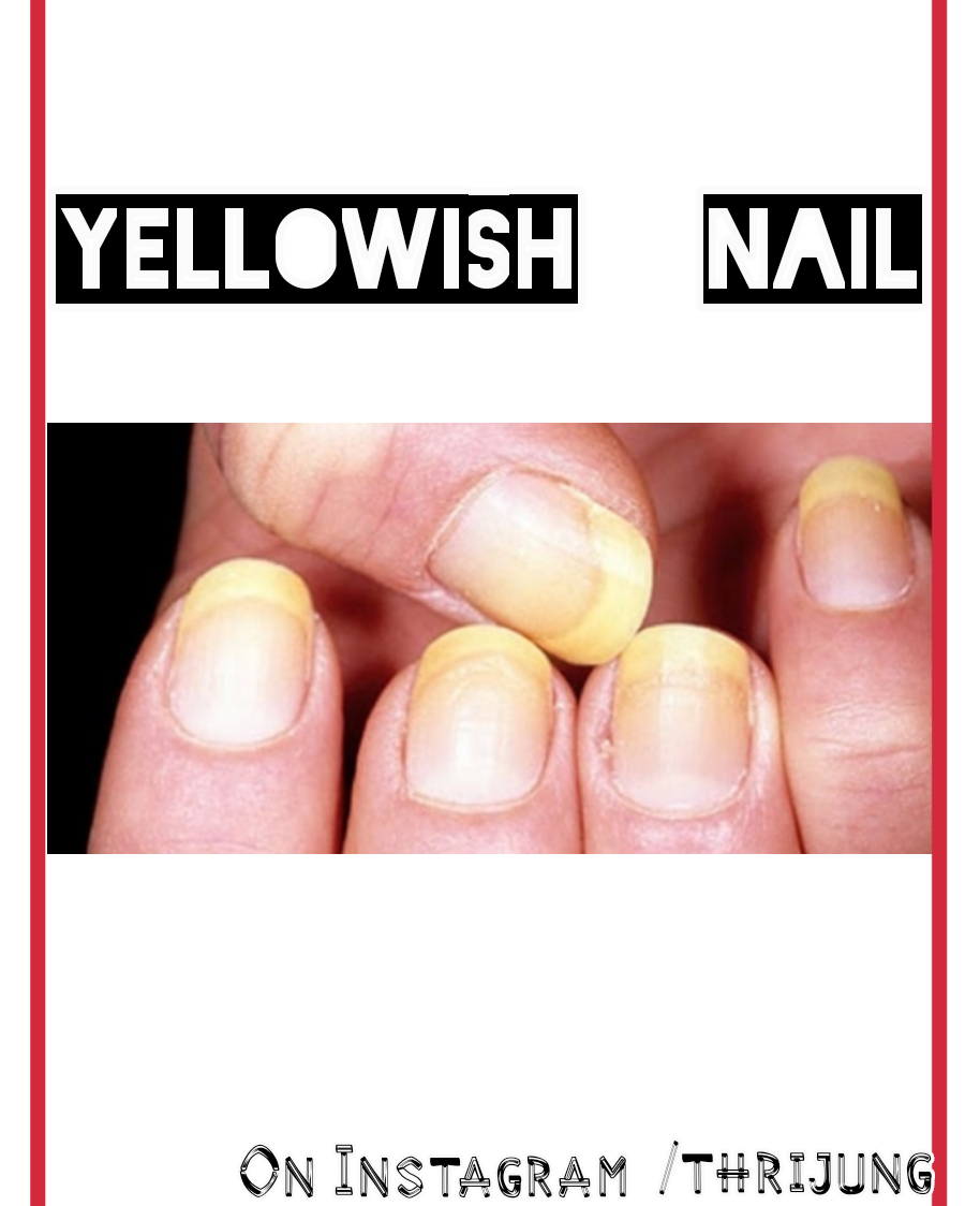 Five tips that nail say about your healthSee how(2019) Thrijung