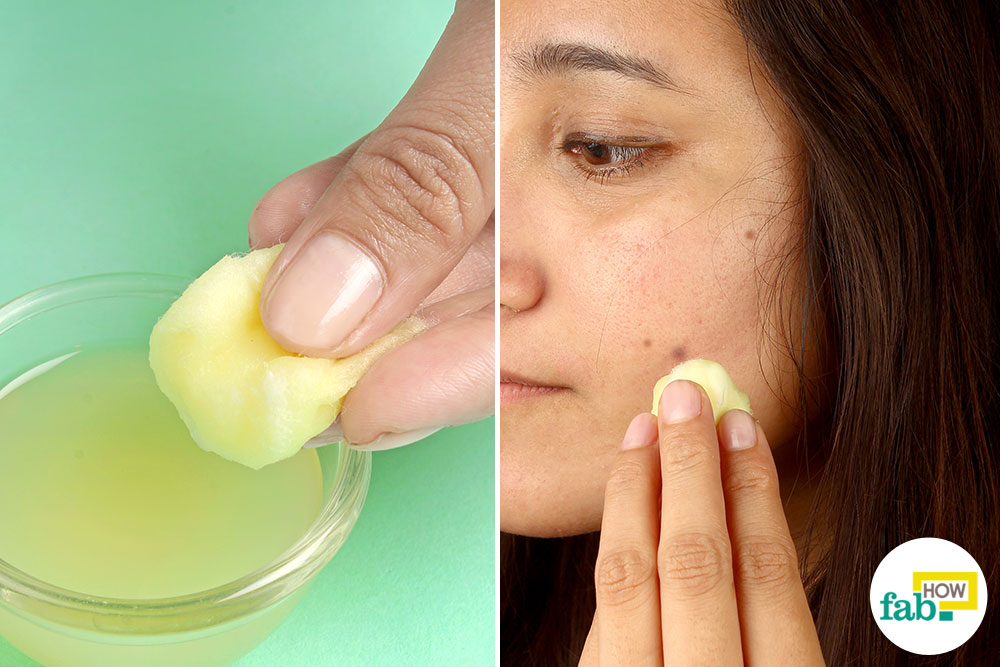 Home Remedies 56 How To Use Lemon To Remove The Spots From Your Face
