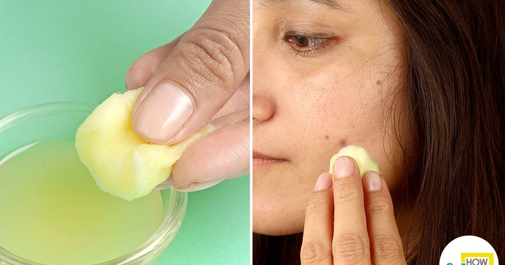 Home Remedies 56 How To Use Lemon To Remove The Spots From Your Face