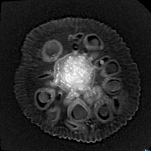 MRI of a Jackfruit