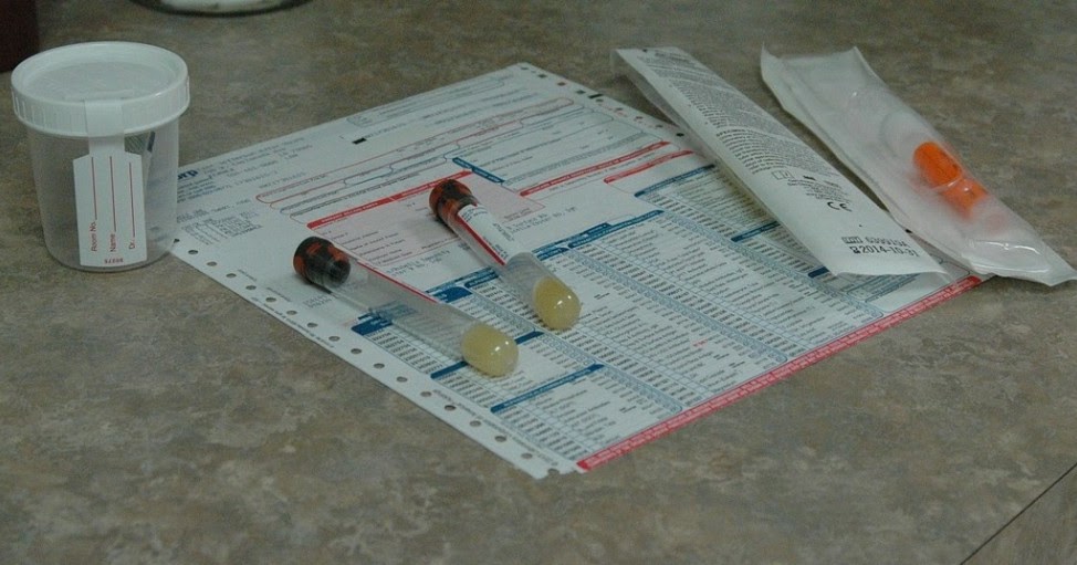 White Blood Cells in Urine During Pregnancy
