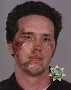 Beaten by police