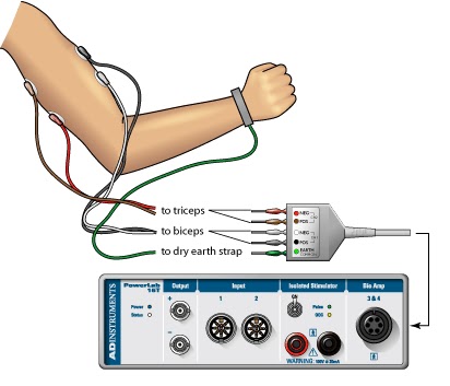 Electromyography (EMG) | Electrotherapy for MSP