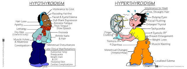 látás hyperthyreosis szem képzés a látás javítása érdekében