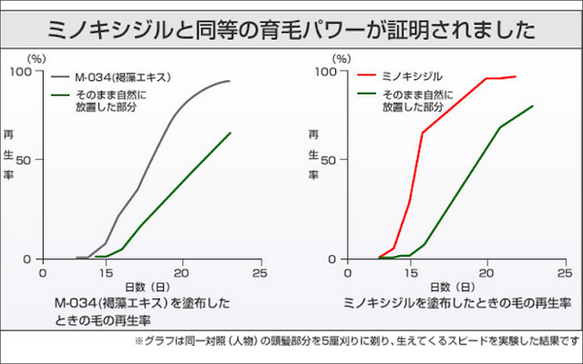 リアップX5歴3年、やめてわかった育毛剤(医薬部外品)との抜け毛の違い!-13 リアップX5歴3年、やめてわかった育毛剤(医薬部外品)との抜け毛の違い!-13