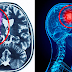 This Plant Proven To Treat 75% Of Tumors And Scientists Confirms Tumors Never Grows Back