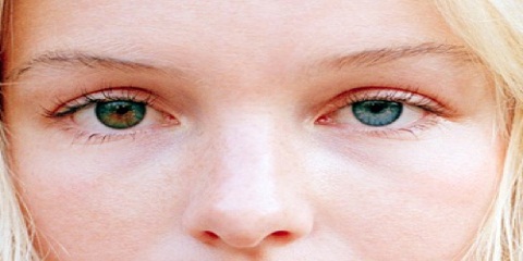 Tentang Heterochromia Iridium - Info Terbaru Terkini